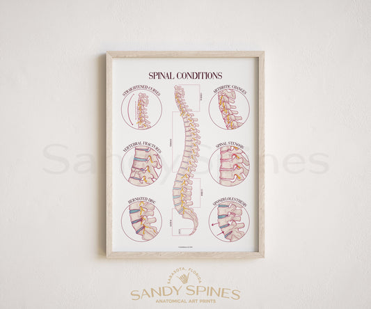 Spinal Conditions Poster