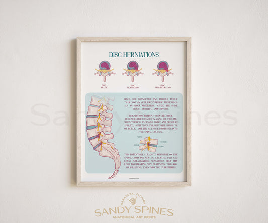 Disc Herniation Poster | 2024 Version