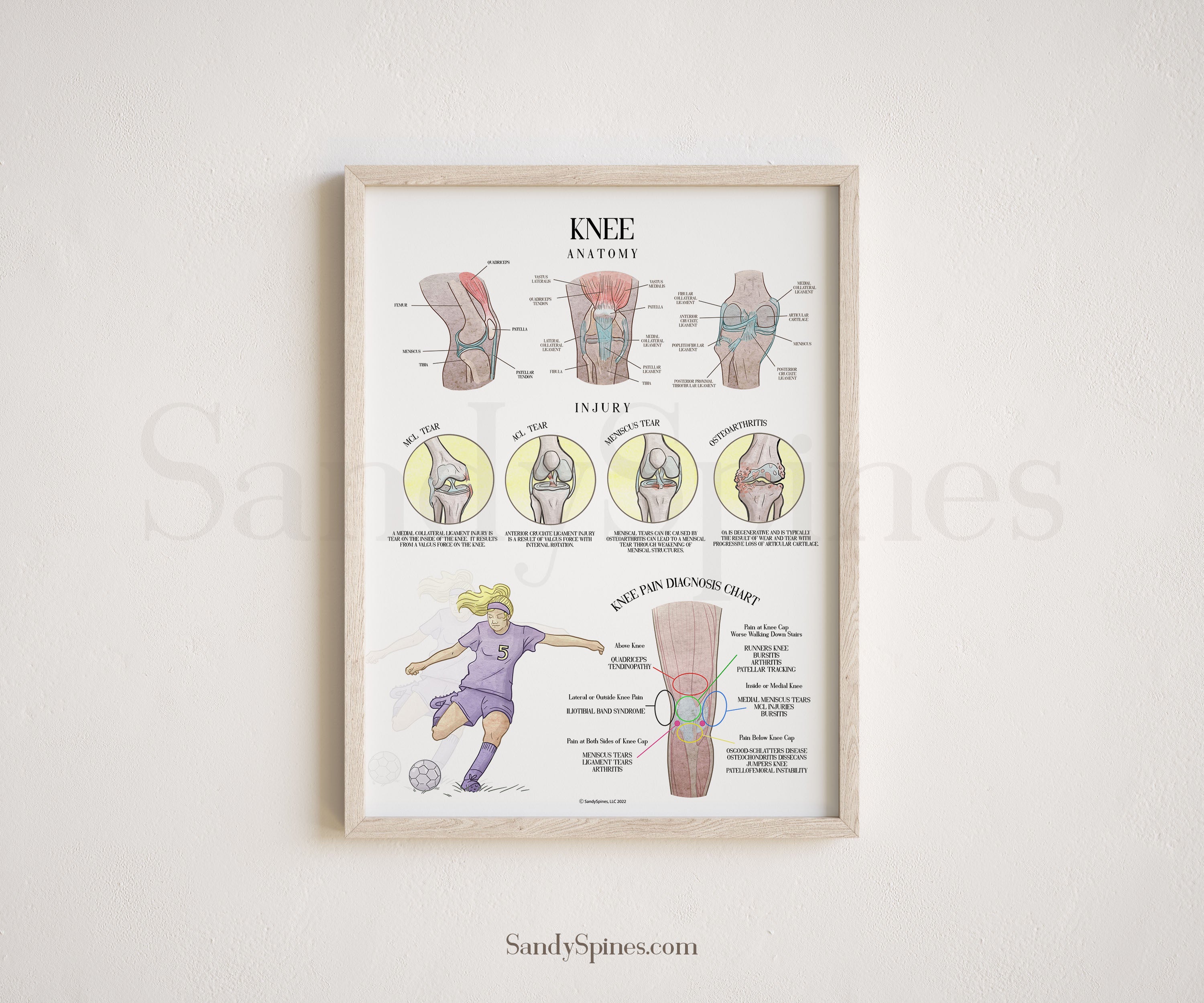 Knee Anatomy And Injury Poster – SandySpines